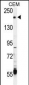 TRPM6 (CHAK2) Antibody (Center)